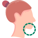 Submental Liposuction